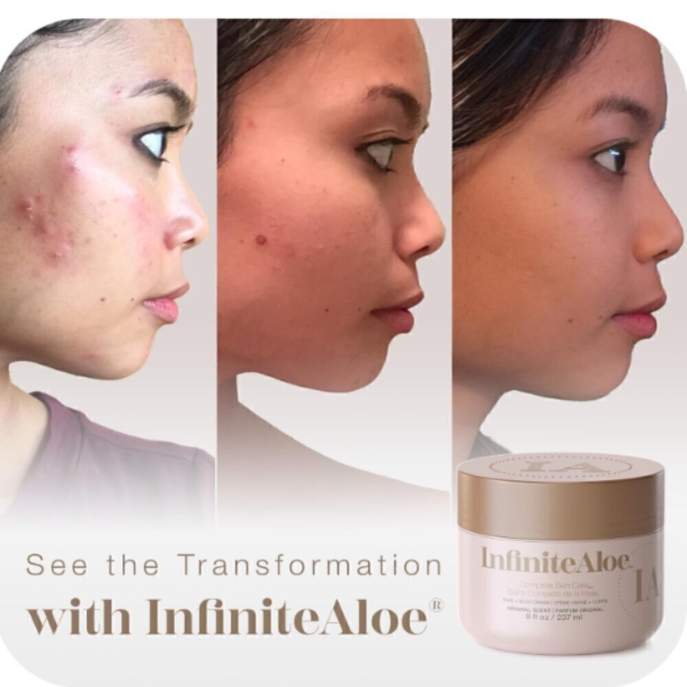 NEW! Infinite Aloe Everyday Hero Skincare Cream 8 OZ+ travel -Original Scent - Picture 7 of 14